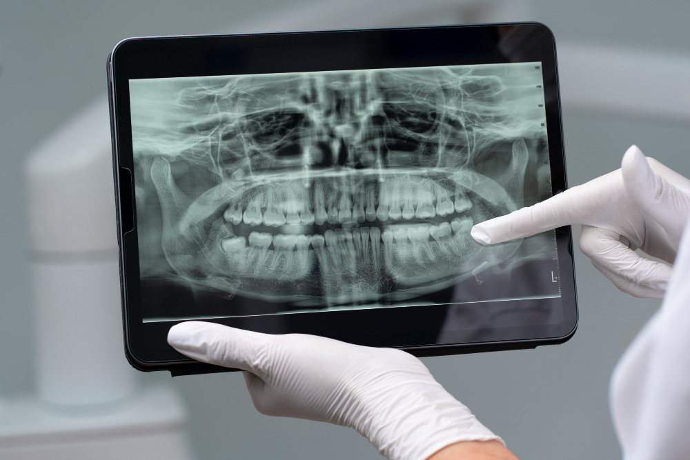 Digital X-Rays  Salt Lake City, UT