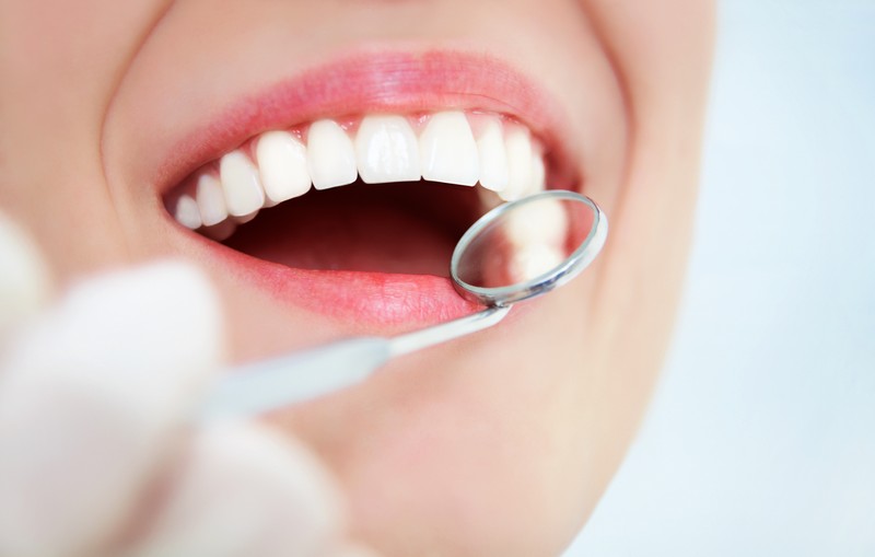 Periodontal Care